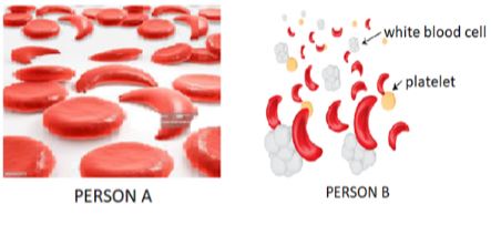 BioForm4ET122p2q1