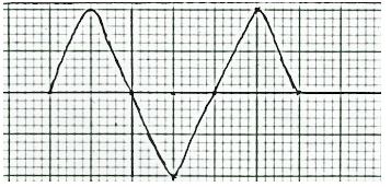 PhysForm4ET122p2q16b