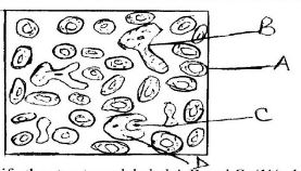 smear of blood on a microscope slide